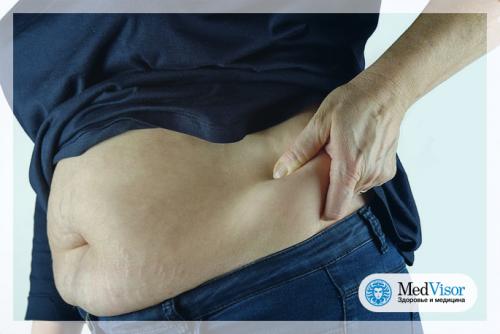 3 простых шага к плоскому животу после 50: как держать форму в зрелом возрасте 02 3 простых шага к плоскому животу после 50: как держать форму в зрелом возрасте 02